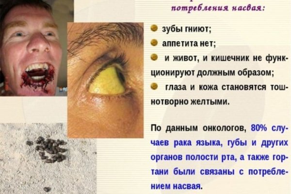 Кракен сбой